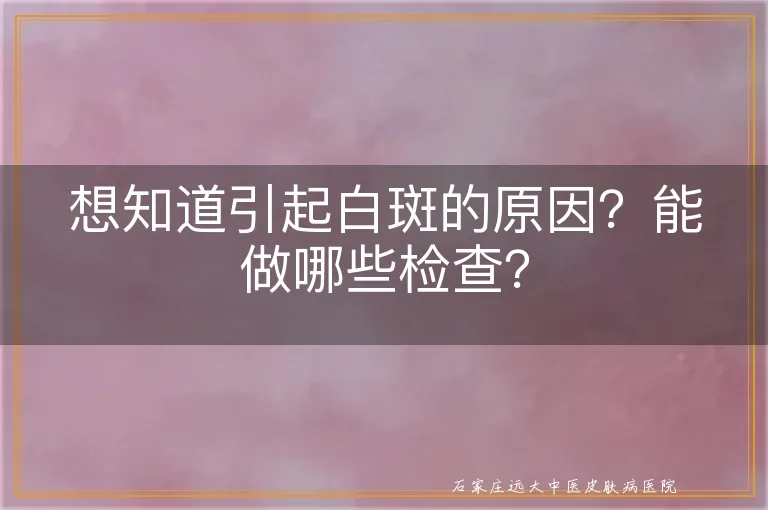 想知道引起白斑的原因？能做哪些检查？