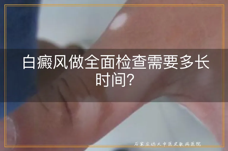 白癜风做全面检查需要多长时间？