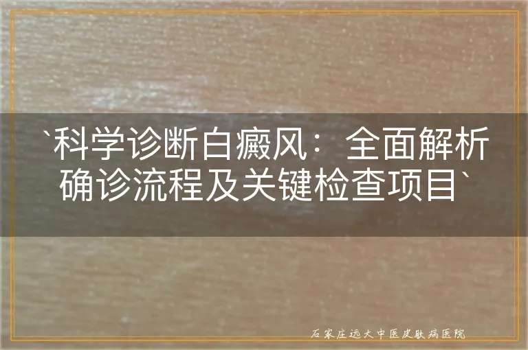 科学诊断白癜风：全面解析确诊流程及关键检查项目