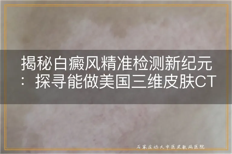 揭秘白癜风精准检测新纪元：探寻能做美国三维皮肤CT的顶尖医院