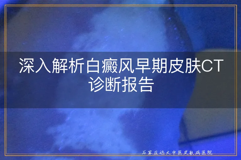 深入解析白癜风早期皮肤CT诊断报告