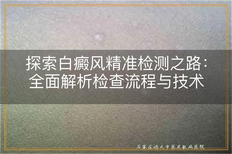 探索白癜风精准检测之路：全面解析检查流程与技术