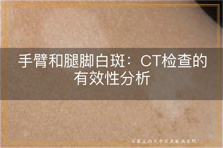 手臂和腿脚白斑：CT检查的有效性分析