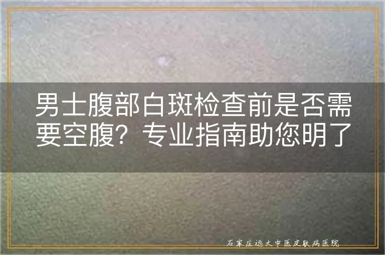 男士腹部白斑检查前是否需要空腹？专业指南助您明了