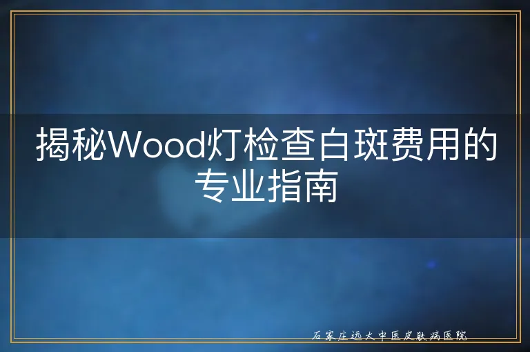 揭秘Wood灯检查白斑费用的专业指南