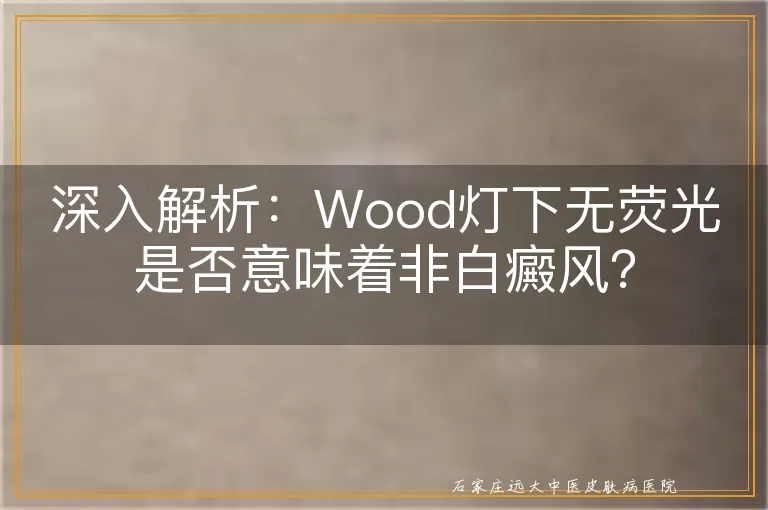 深入解析：Wood灯下无荧光是否意味着非白癜风？