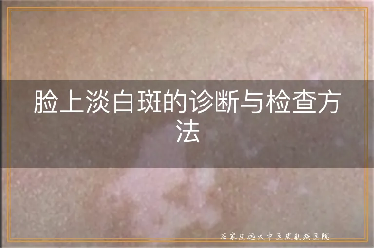 脸上淡白斑的诊断与检查方法