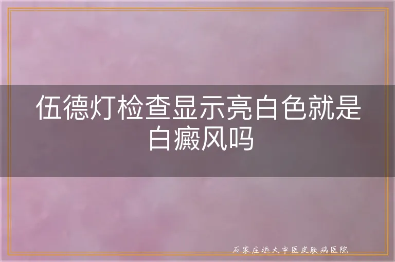 伍德灯检查显示亮白色就是白癜风吗