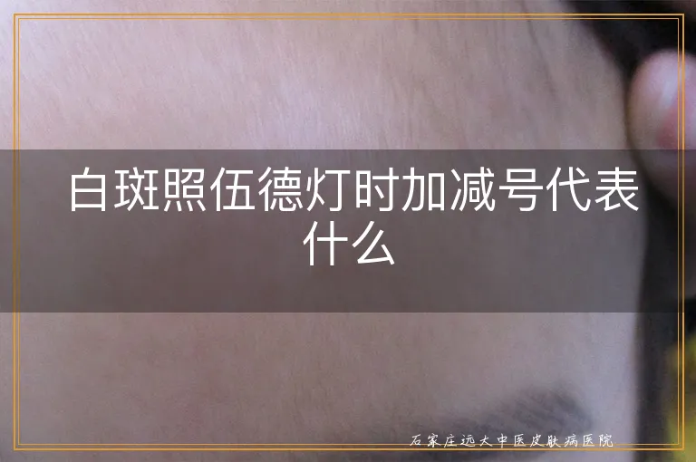 白斑照伍德灯时加减号代表什么