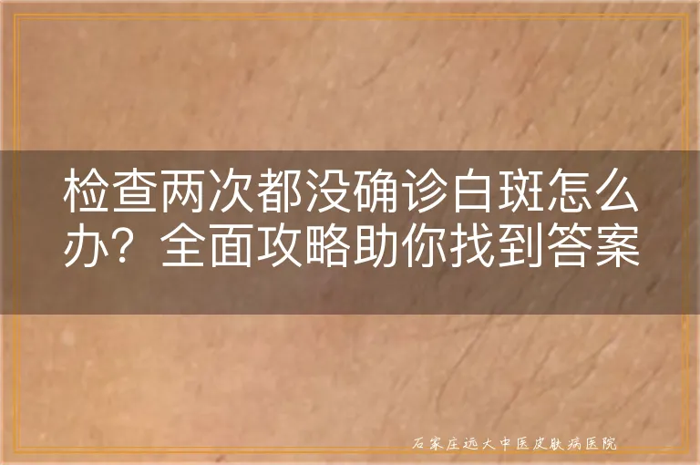 检查两次都没确诊白斑怎么办？全面攻略助你找到答案