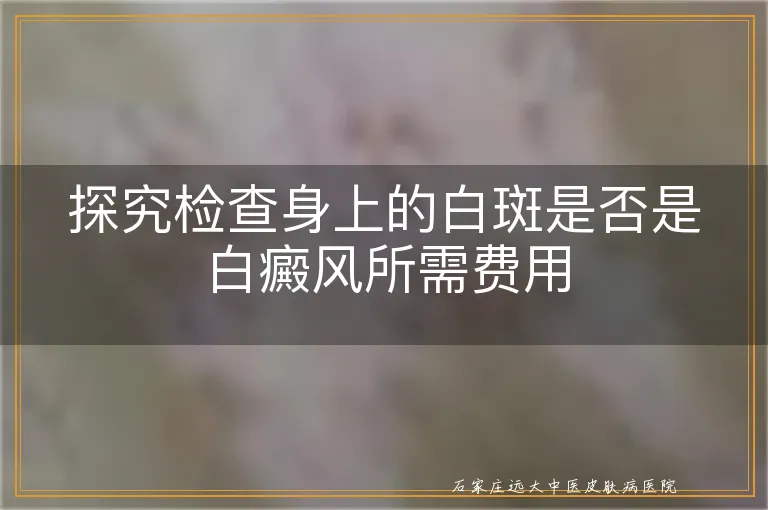 探究检查身上的白斑是否是白癜风所需费用