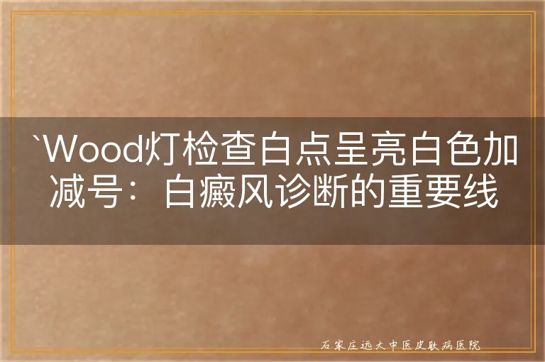 Wood灯检查白点呈亮白色加减号：白癜风诊断的重要线索