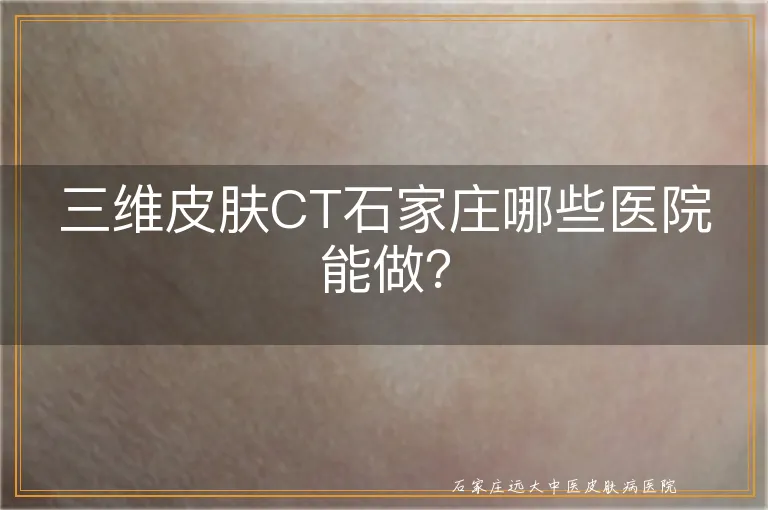 三维皮肤CT石家庄哪些医院能做？