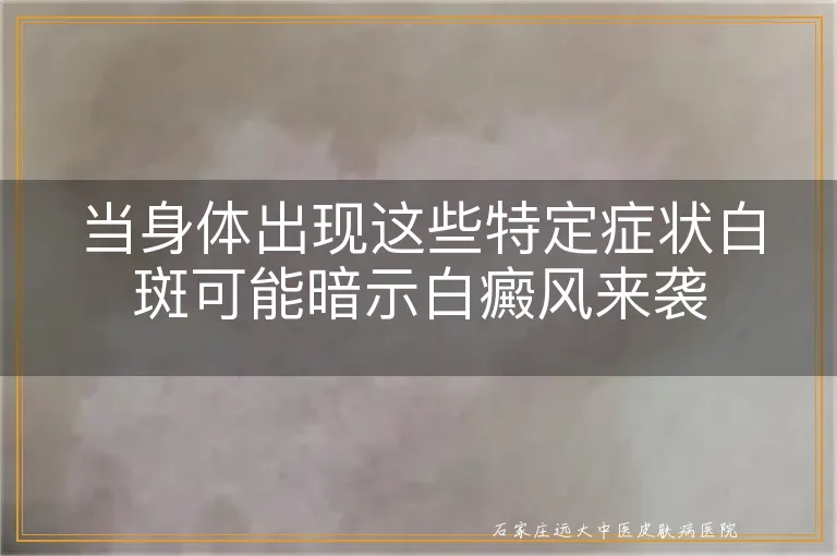 当身体出现这些特定症状白斑可能暗示白癜风来袭