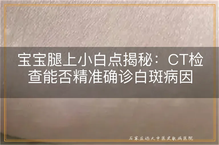 宝宝腿上小白点揭秘：CT检查能否精准确诊白斑病因