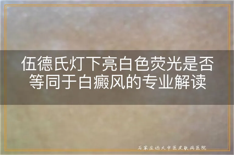 伍德氏灯下亮白色荧光是否等同于白癜风的专业解读