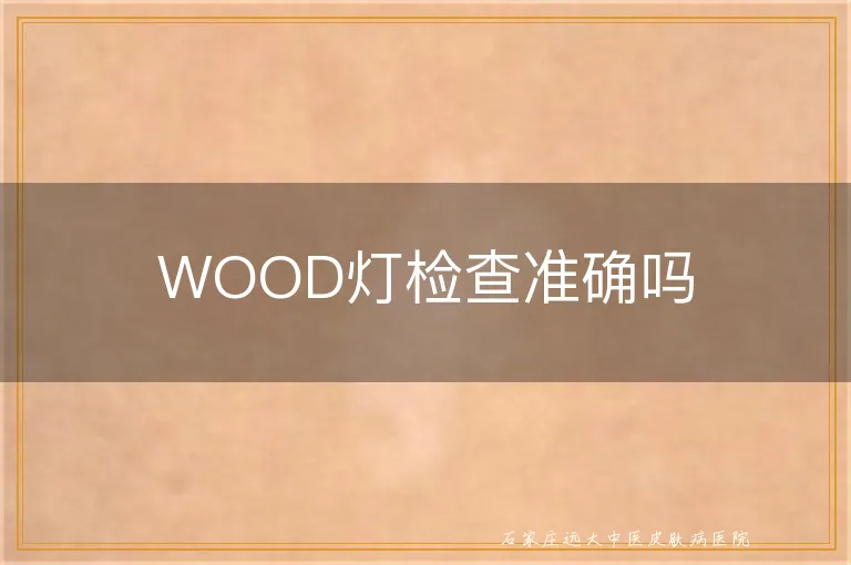 WOOD灯检查准确吗