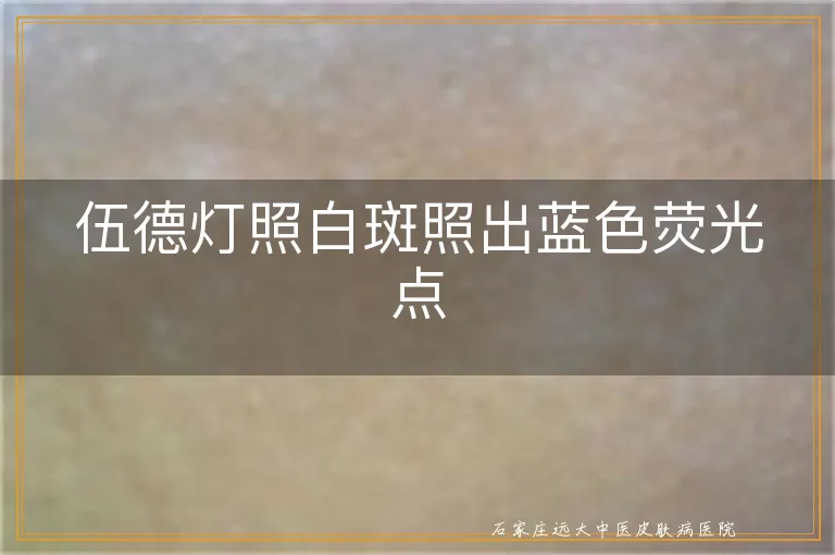 伍德灯照白斑照出蓝色荧光点