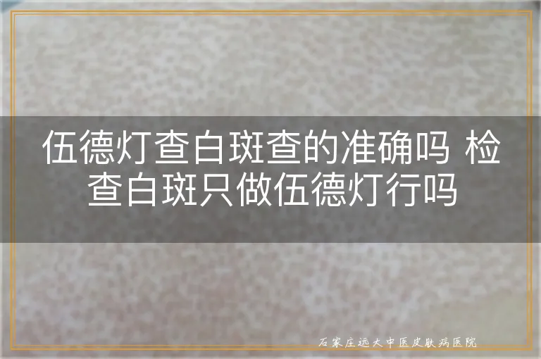 伍德灯查白斑查的准确吗 检查白斑只做伍德灯行吗