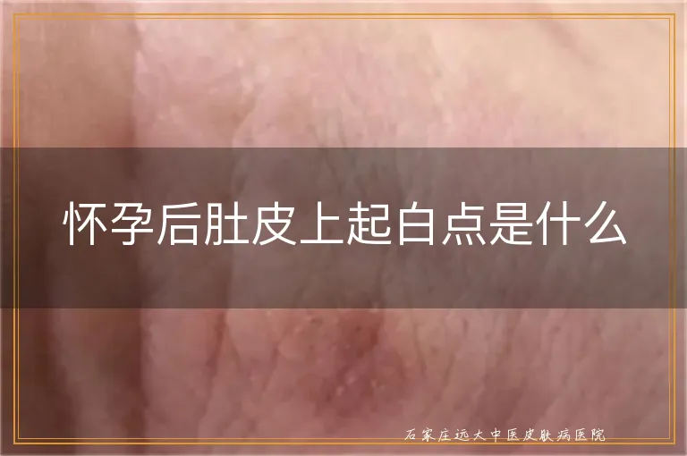 怀孕后肚皮上起白点是什么