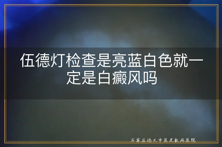 伍德灯检查是亮蓝白色就一定是白癜风吗