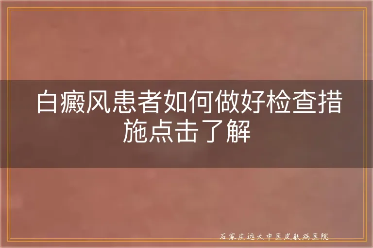 白癜风患者如何做好检查措施点击了解