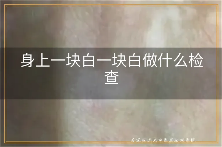 身上一块白一块白做什么检查