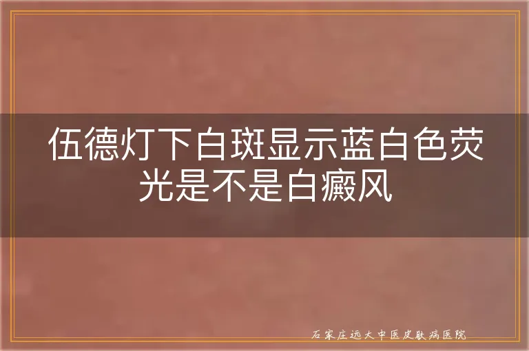 伍德灯下白斑显示蓝白色荧光是不是白癜风