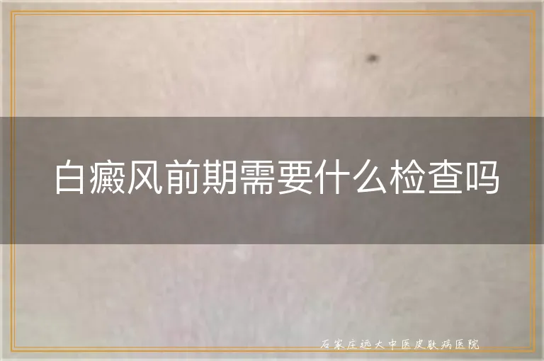 白癜风前期需要什么检查吗