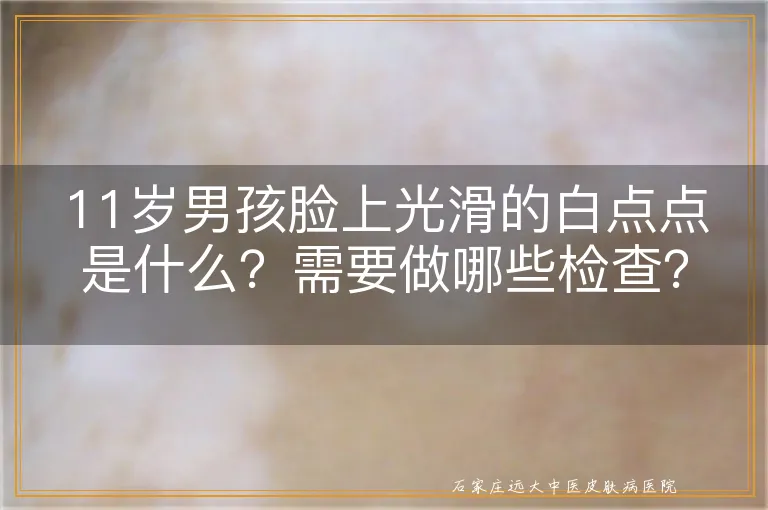 11岁男孩脸上光滑的白点点是什么？需要做哪些检查？