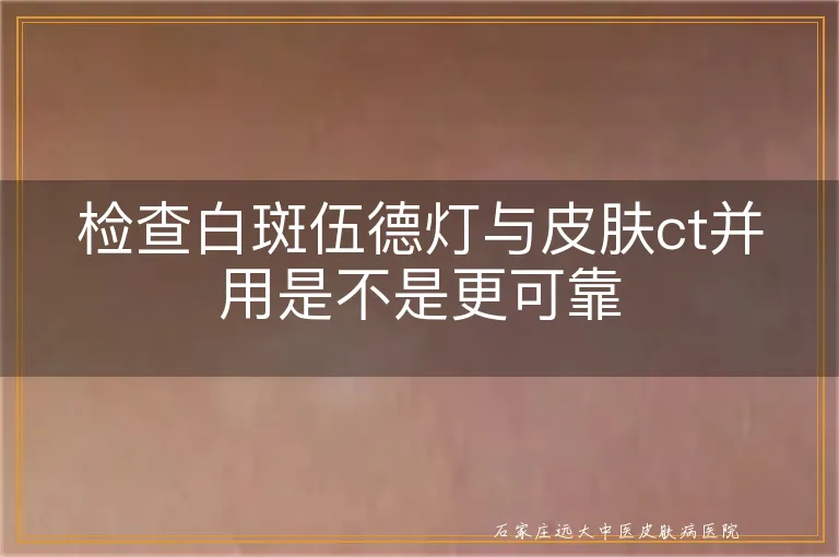 检查白斑伍德灯与皮肤ct并用是不是更可靠