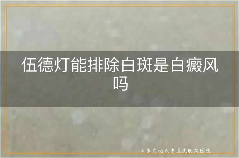 伍德灯能排除白斑是白癜风吗