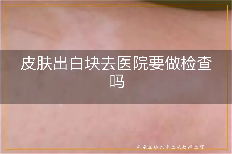 皮肤出白块去医院要做检查吗