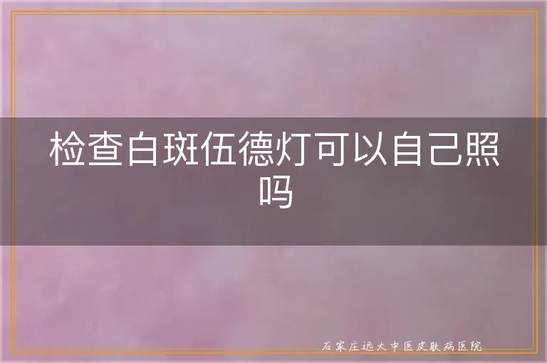 检查白斑伍德灯可以自己照吗