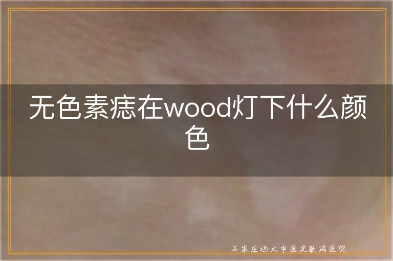 无色素痣在wood灯下什么颜色