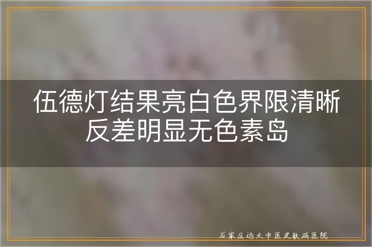 伍德灯结果亮白色界限清晰反差明显无色素岛