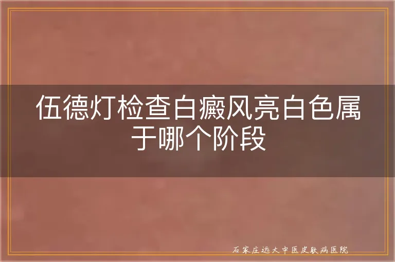 伍德灯检查白癜风亮白色属于哪个阶段