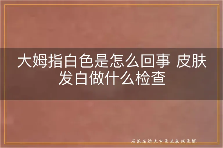 大姆指白色是怎么回事 皮肤发白做什么检查