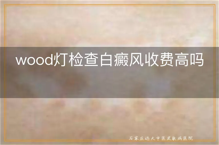 wood灯检查白癜风收费高吗