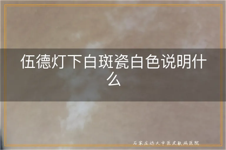 伍德灯下白斑瓷白色说明什么