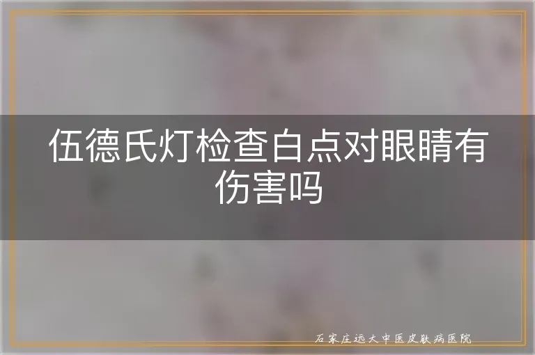 伍德氏灯检查白点对眼睛有伤害吗