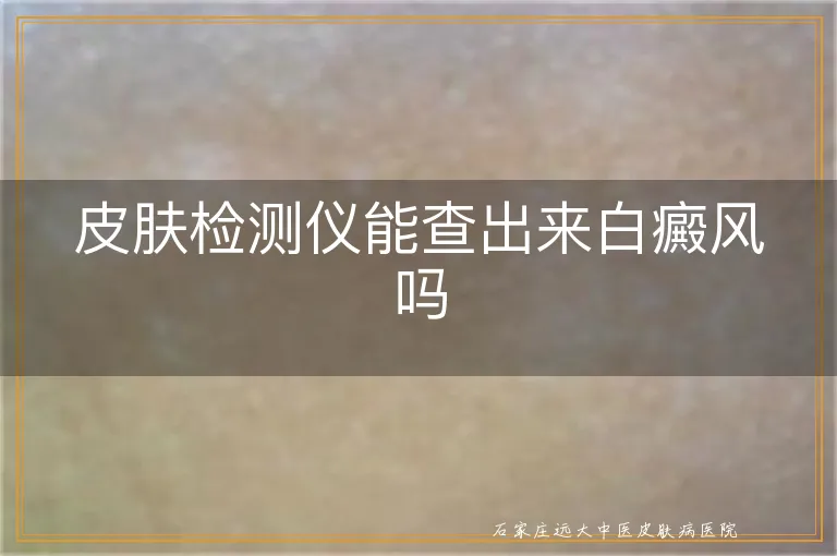 皮肤检测仪能查出来白癜风吗