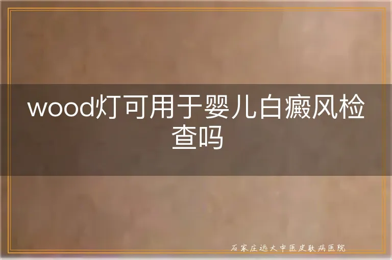 wood灯可用于婴儿白癜风检查吗