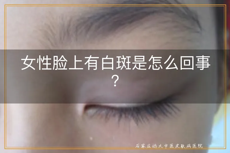 女性脸上有白斑是怎么回事？