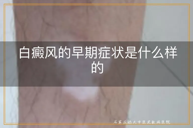 白癜风的早期症状是什么样的