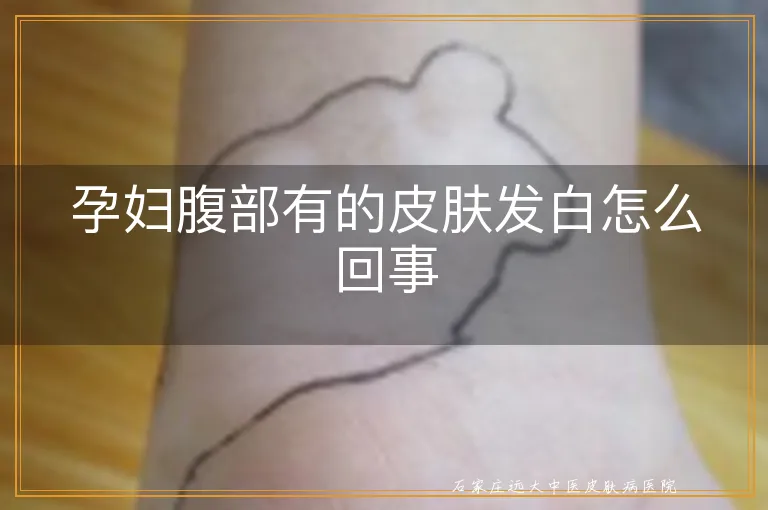 孕妇腹部有的皮肤发白怎么回事