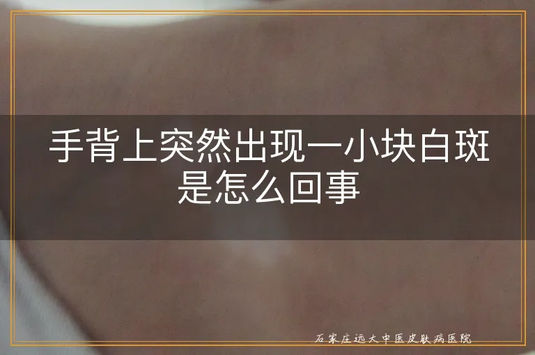 手背上突然出现一小块白斑是怎么回事