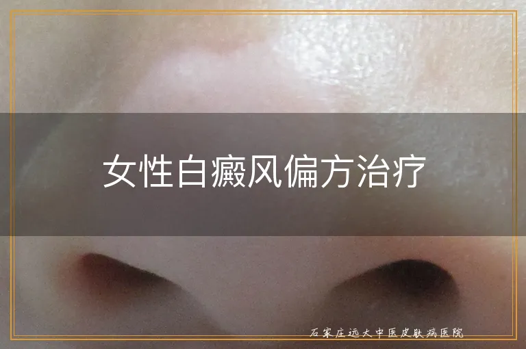 女性白癜风偏方治疗