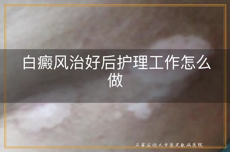 白癜风治好后护理工作怎么做