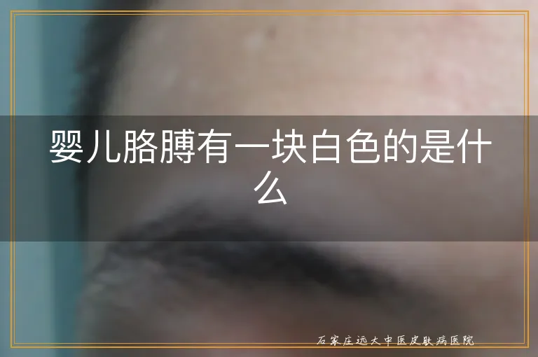 婴儿胳膊有一块白色的是什么